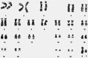 Teens can learn if they’re carriers for Ashkenazic, Sephardic genetic diseases
