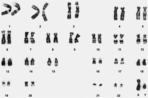 Teens can learn if theyre carriers for Ashkenazic, Sephardic genetic diseases